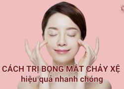 7 Cách trị bọng mắt chảy xệ hiệu quả nhanh chóng đừng bỏ qua